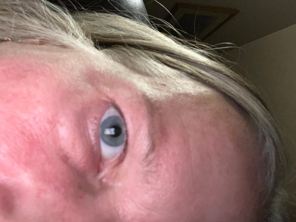 Bright Eyes Masks - Customer Photo From Sondra Snyder