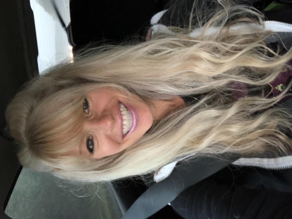 Vitamin C Serum - Customer Photo From Deborah L.