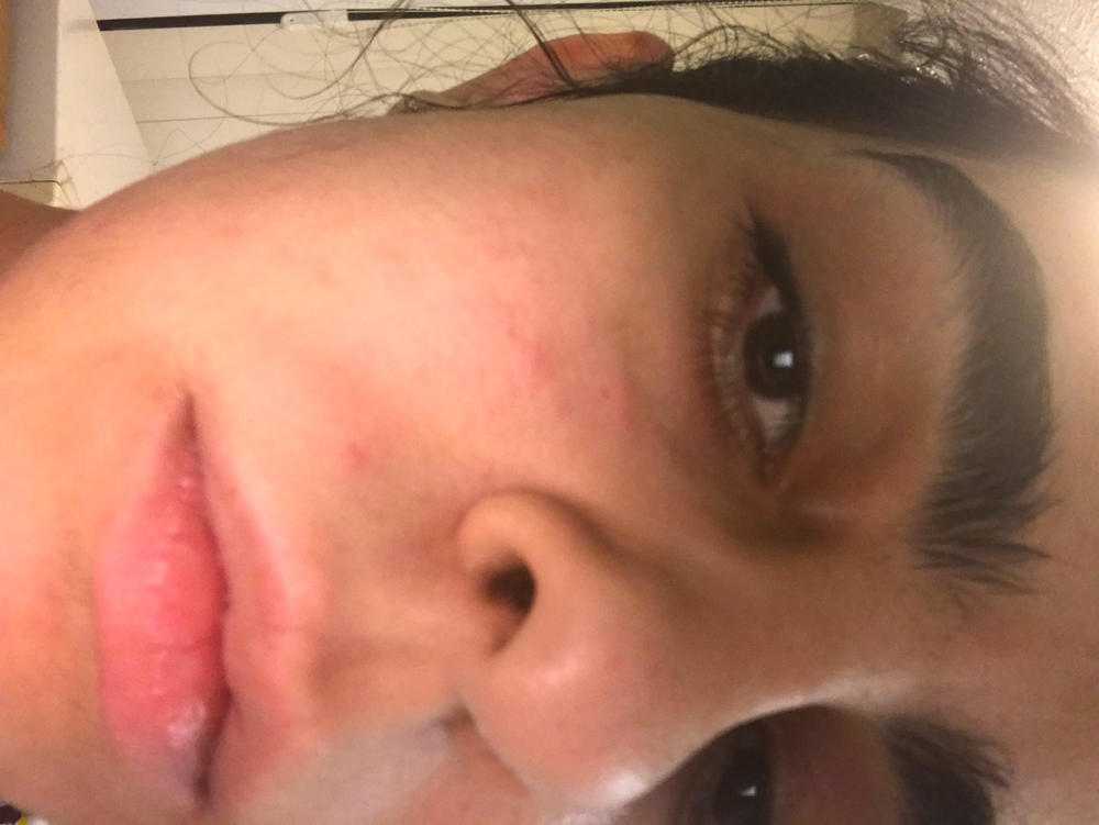 Vitamin C Serum - Customer Photo From Mahsa Koushkebaghi