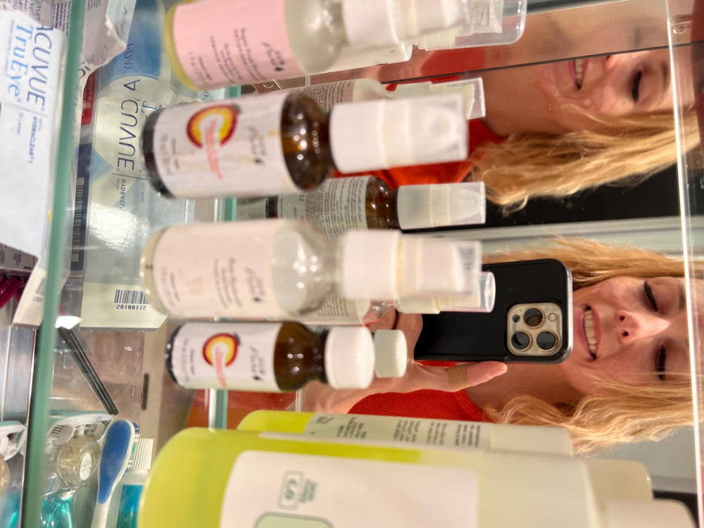 Vitamin C Serum - Customer Photo From Anna Wroclawski